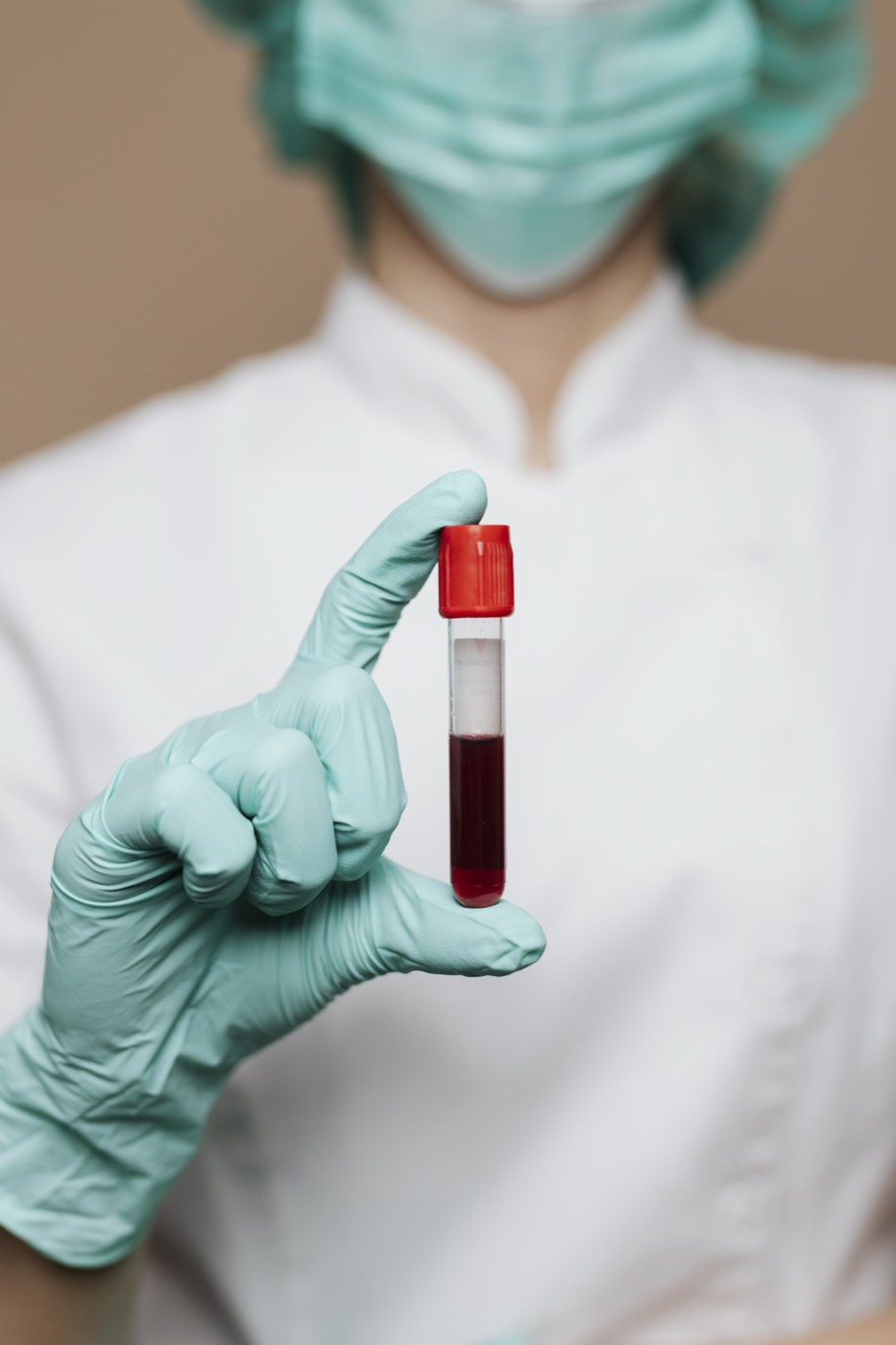 A healthcare worker holding a blood sample tube